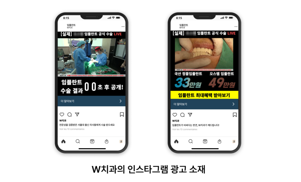 치과 마케팅 광고 소재