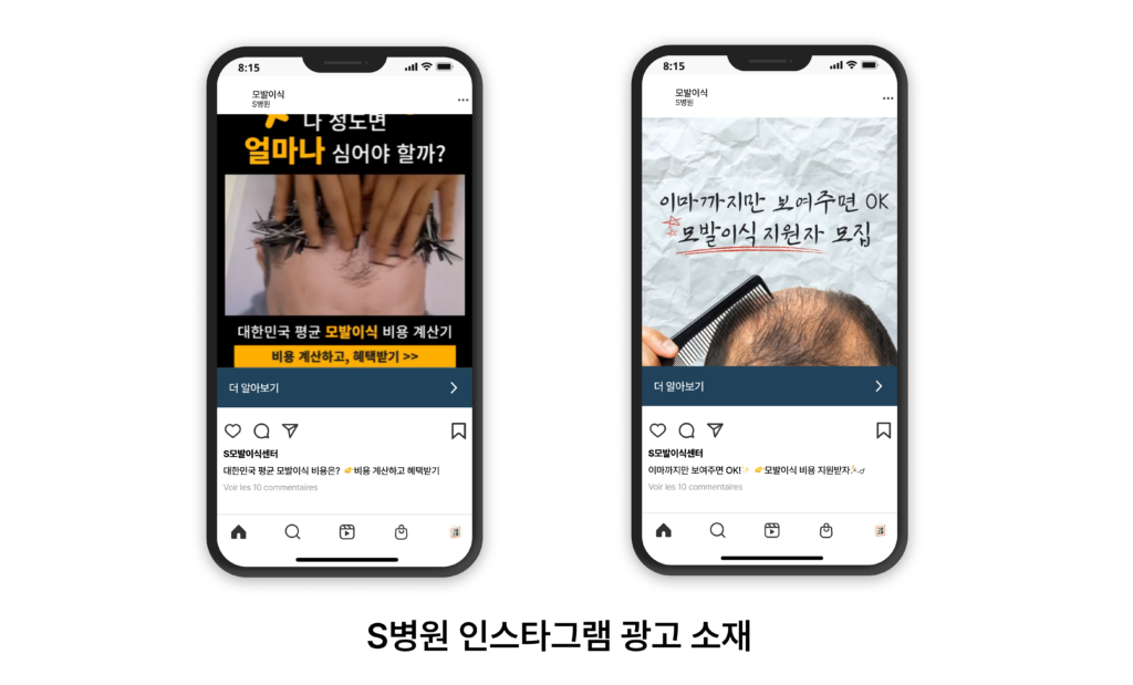 위픽부스터 모발이식 병원 마케팅 광고 소재