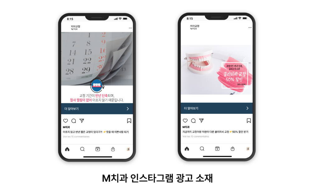 지방 치과 클리닉의 SNS 마케팅 혁신 사례