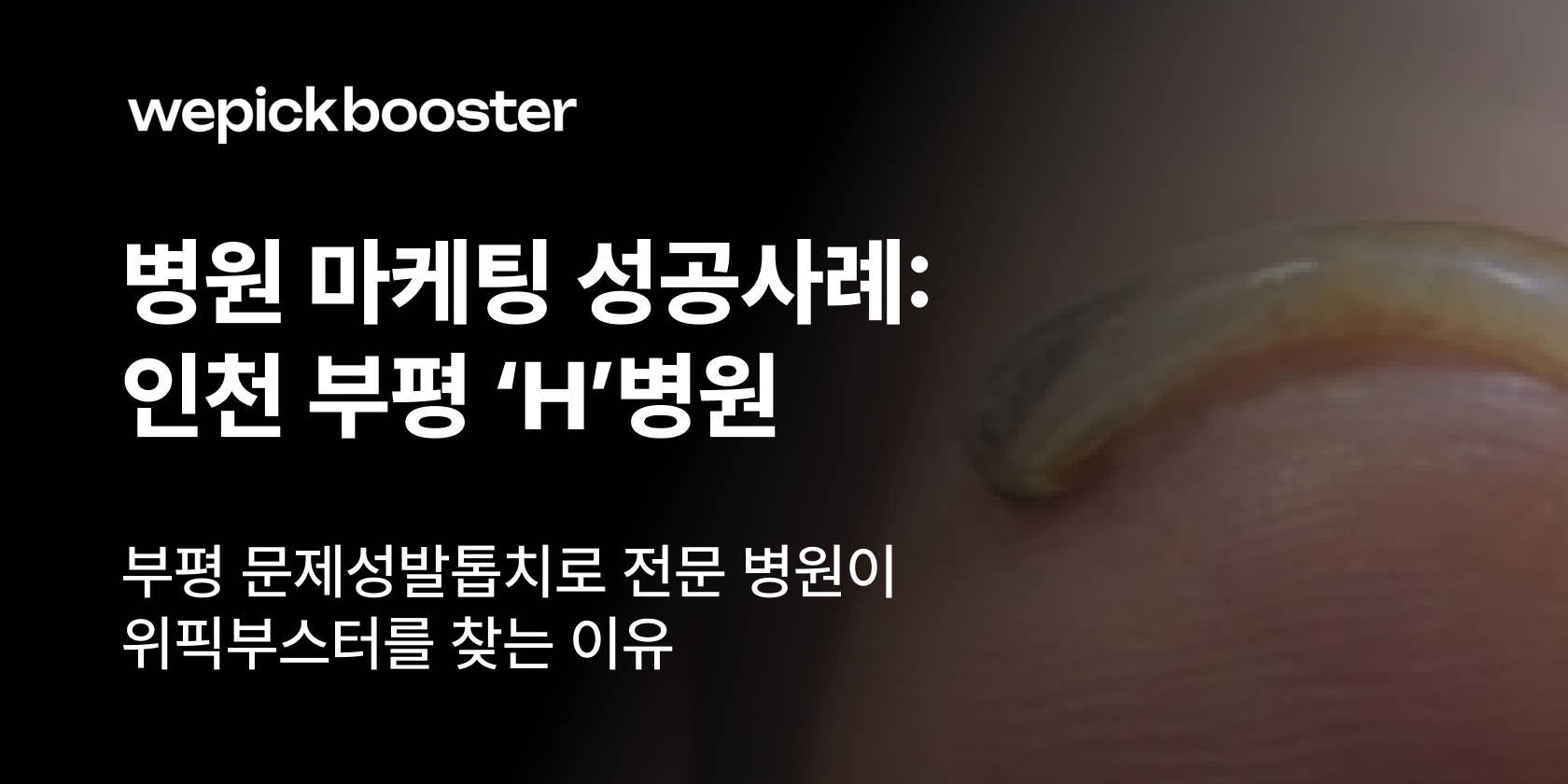 병원 마케팅